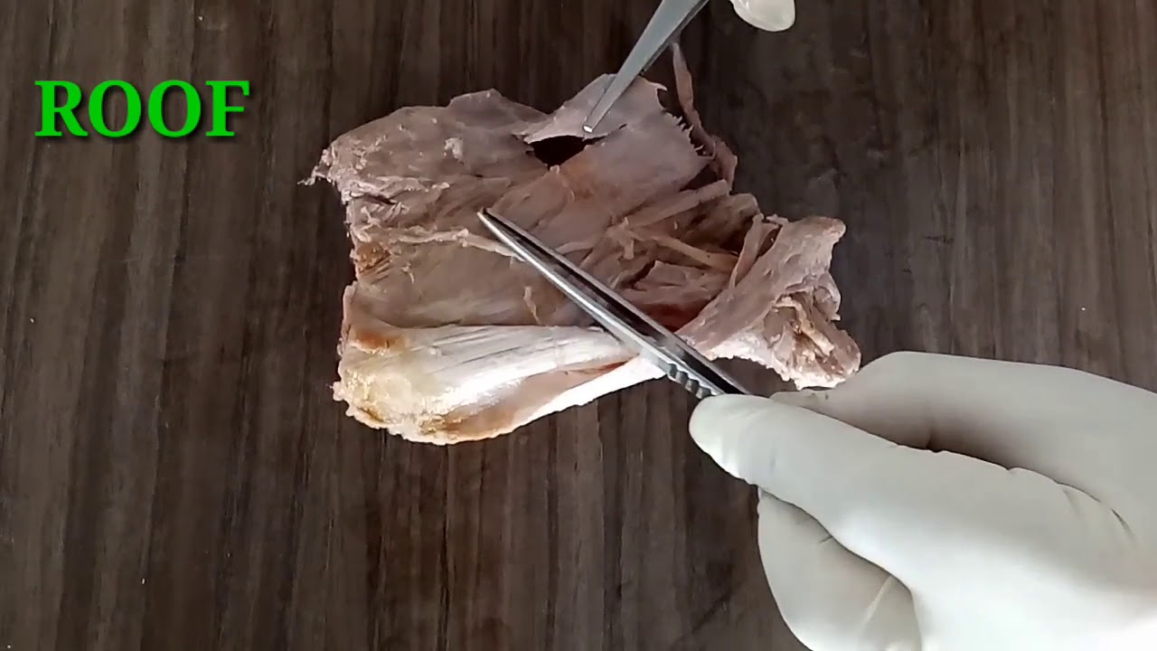 INGUINAL CANAL - BY DR MITESH DAVE