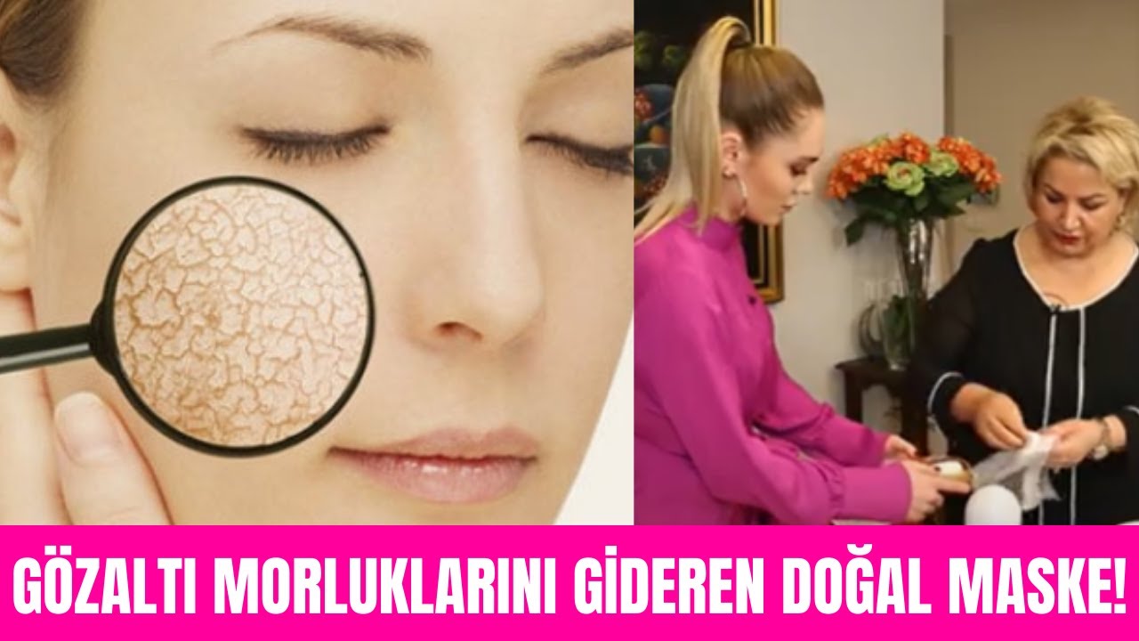 Soğuk havalarda kuruyan ciltlere elveda! Organik yüz maskesi tarifleri Son Moda'da!
