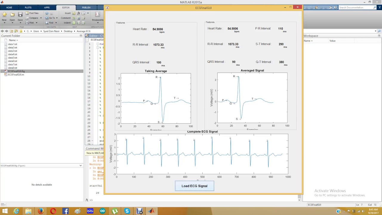 ECG Averaging in MATLAB
