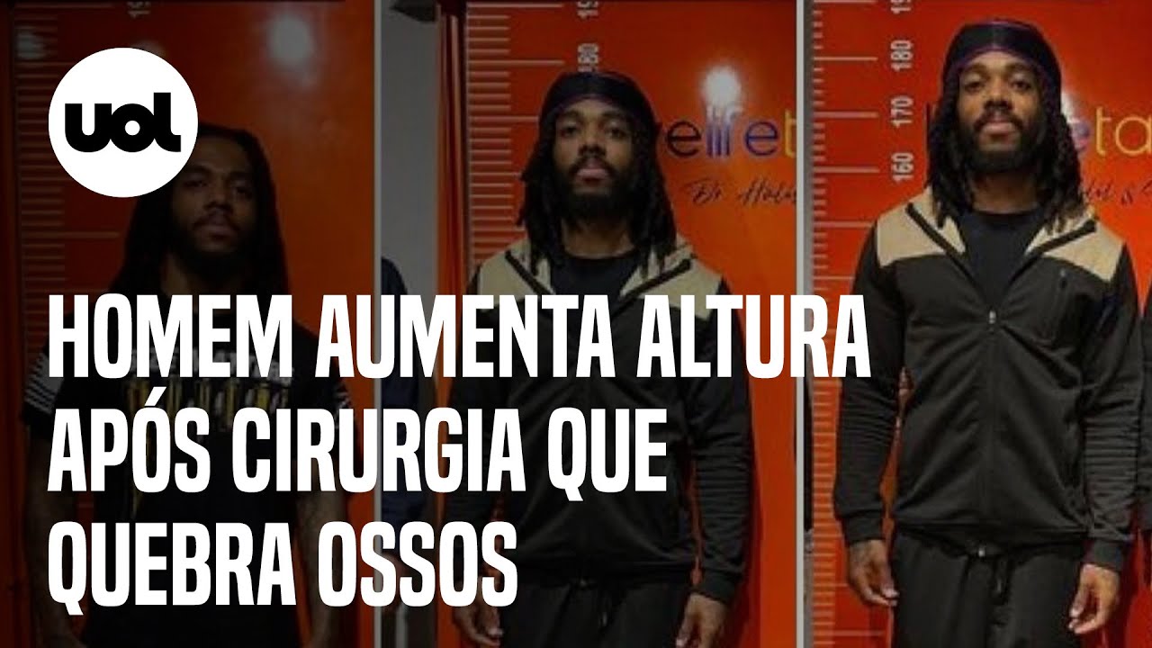 Homem aumenta de tamanho com cirurgia que quebra ossos e custa cerca de R$ 345 mil