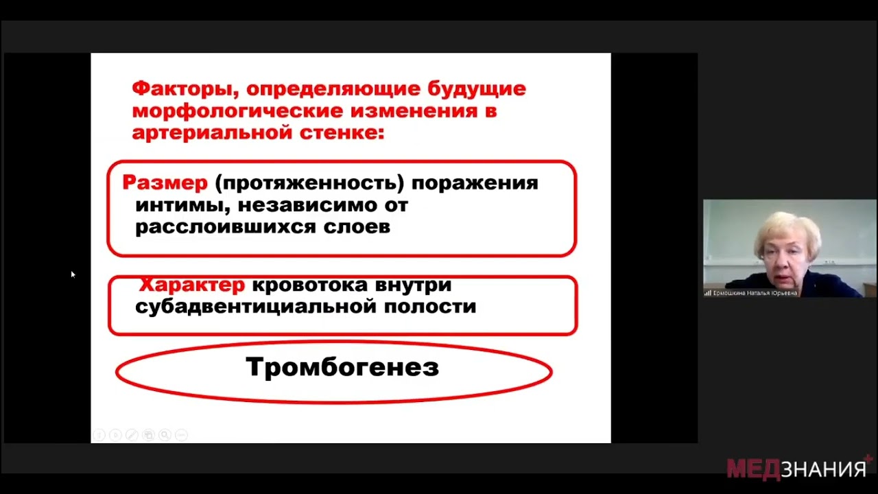 12  Диссекция церебральных артерий 28 10