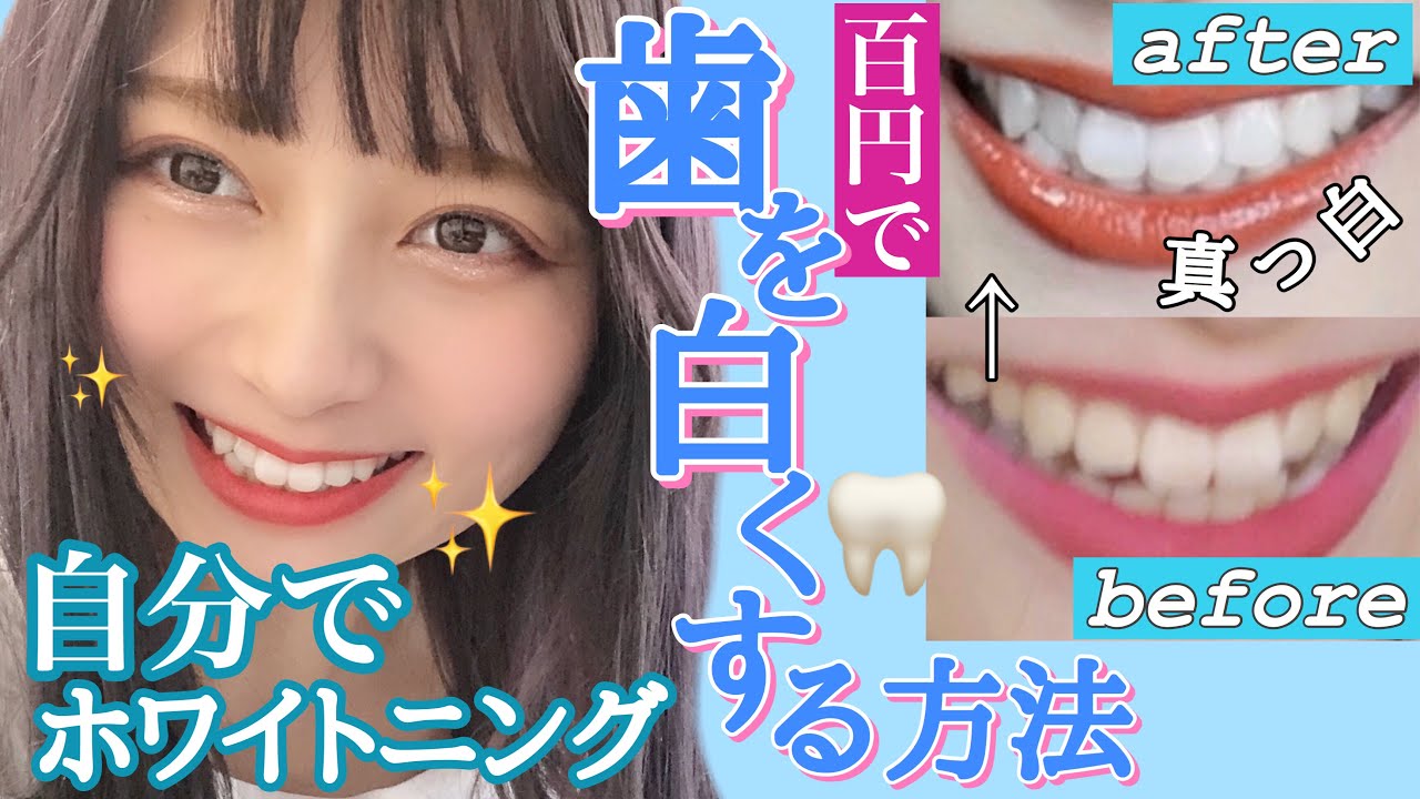 【１回100円】超簡単に家で歯を圧倒的に真っ白にする方法！！！！私のセルフホワイトニングを紹介したよ！【３Dクレスト】