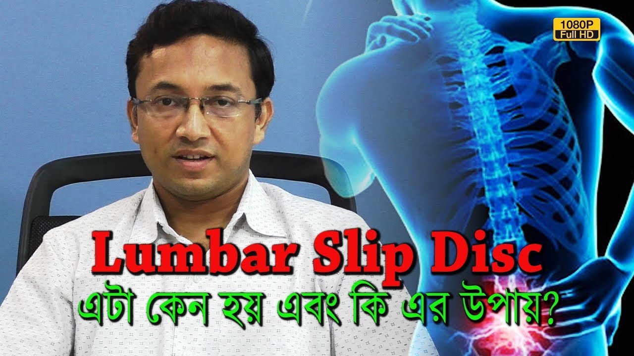 আজকাল আমাদের সবারই খুব কোমরে ব্যাথা হয়।কেন হয়? কি বা এর উপায়? | Dr. S Sarkar - Ortho | EP 654