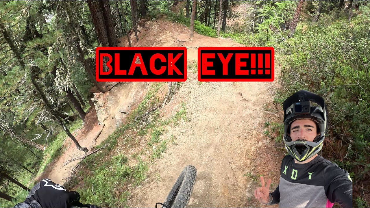 BLACK EYE Mottolino bike park!
