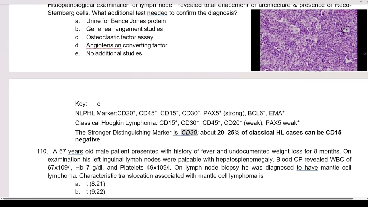 Hematology Masterfile MCQs 101- 150 by Dr Sahrish