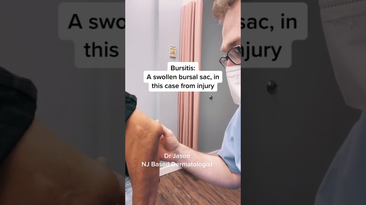 Have You Ever Heard of Bursitis?