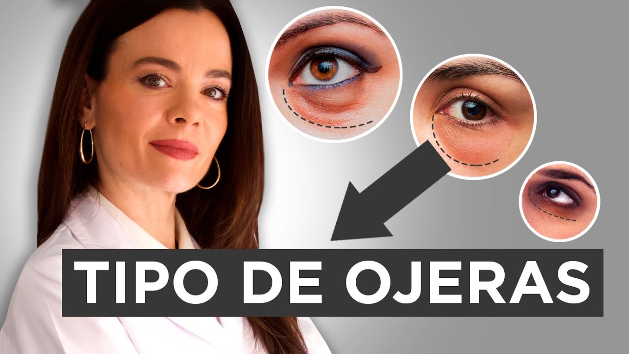 Eliminar las ojeras PARA SIEMPRE: Contorno de ojos LICO, Eucerin, Parches CSIC, y tipos de Ojeras 👀