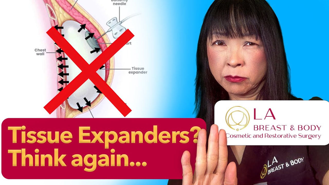 Top 5 reasons to say 'NO' to tissue expanders by Plastic surgeon