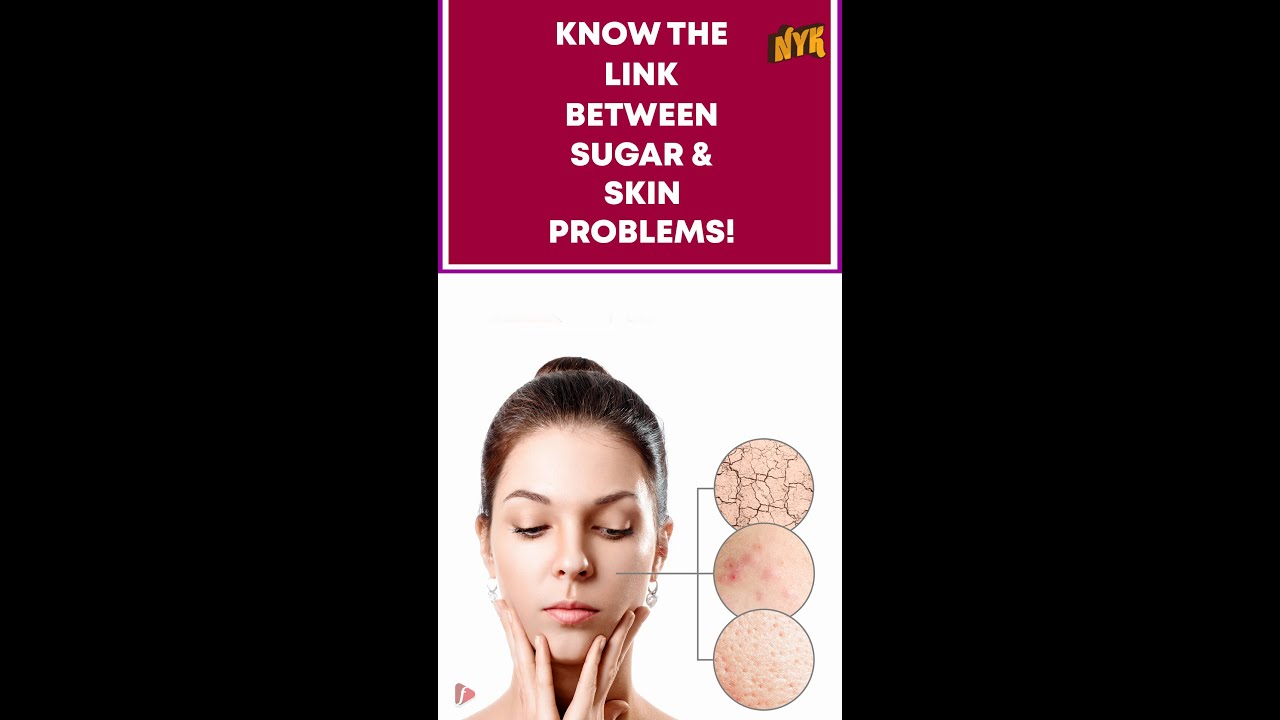 Why Sugar Is Bad For Your Skin?