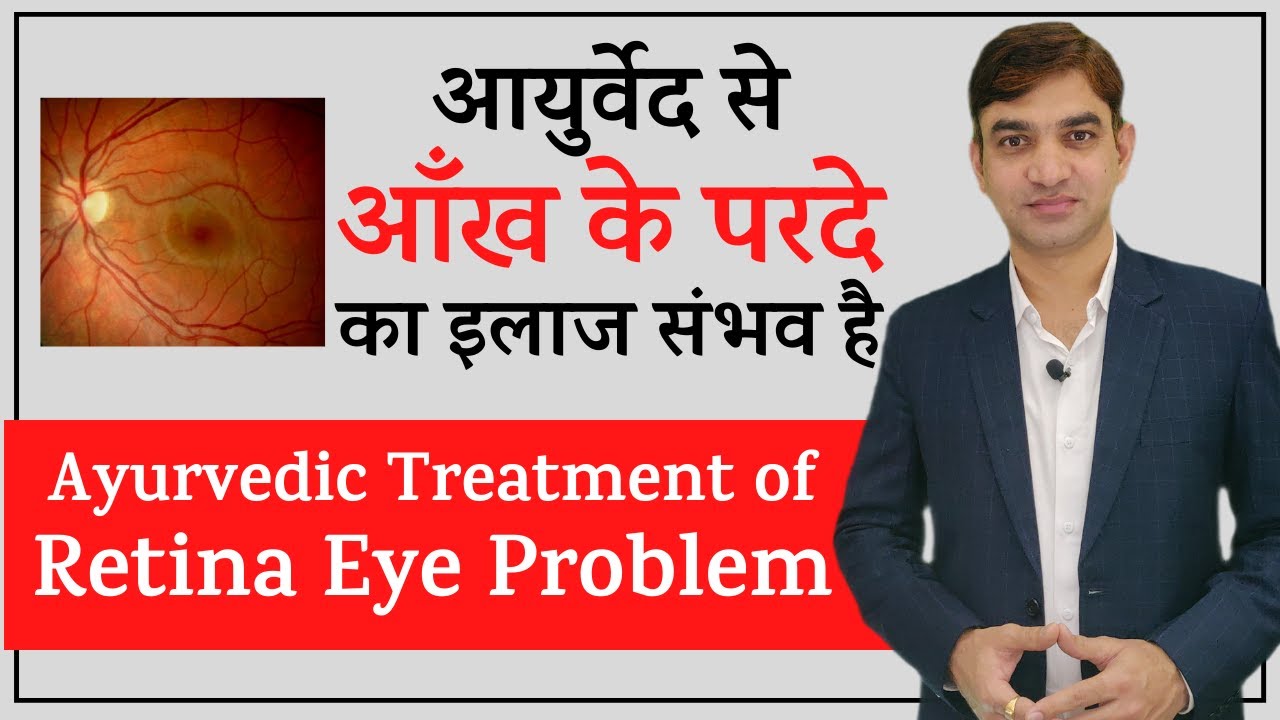 Ayurvedic Treatment for Retina Eye Problems || Treatment of retina is possible with Ayurveda
