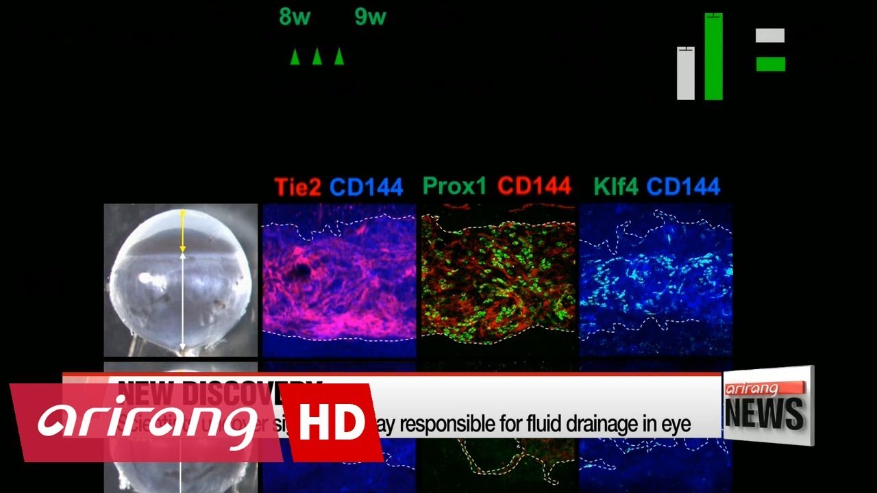 Korean researchers discover path to new glaucoma treatment methods