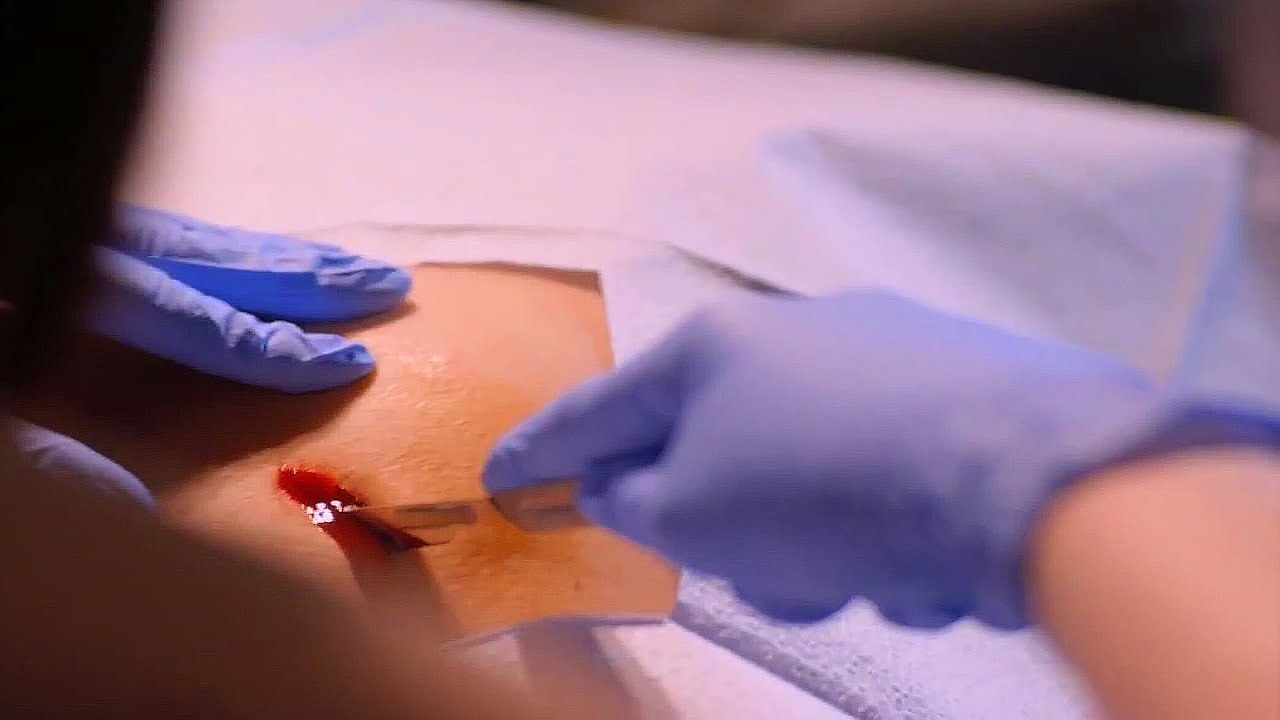 Stargate Universe - Remote Surgery