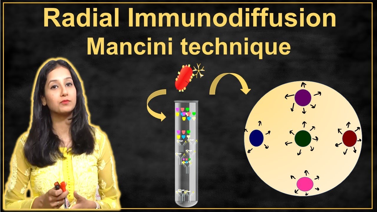 Radial Immunodiffusion I Mancini technique I Immunotechnique II Immunology