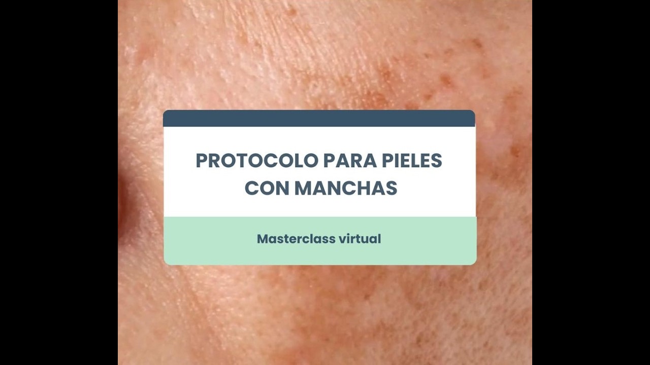 ✨ Masterclass: Protocolo para pieles con manchas – con productos LACA. Tec. Alejandra Rodriguez