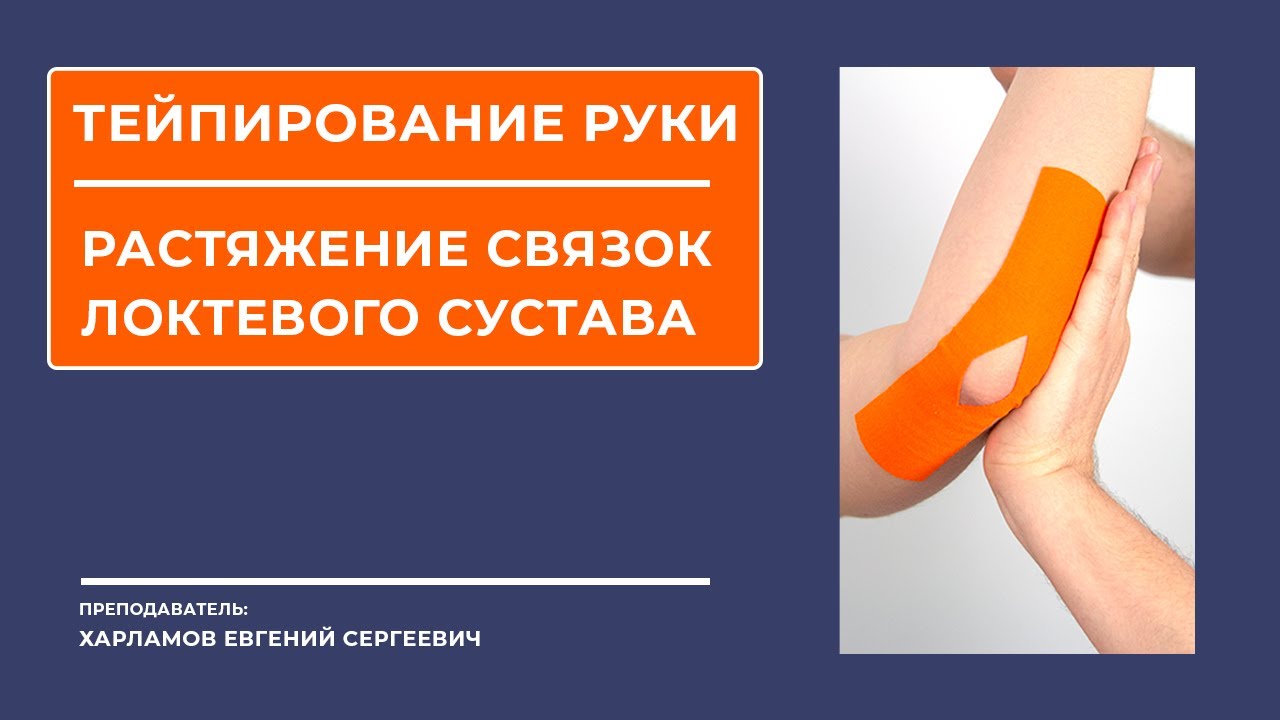 Тейпирование руки. Тейпирование локтя. Растяжение связок локтевого сустава.