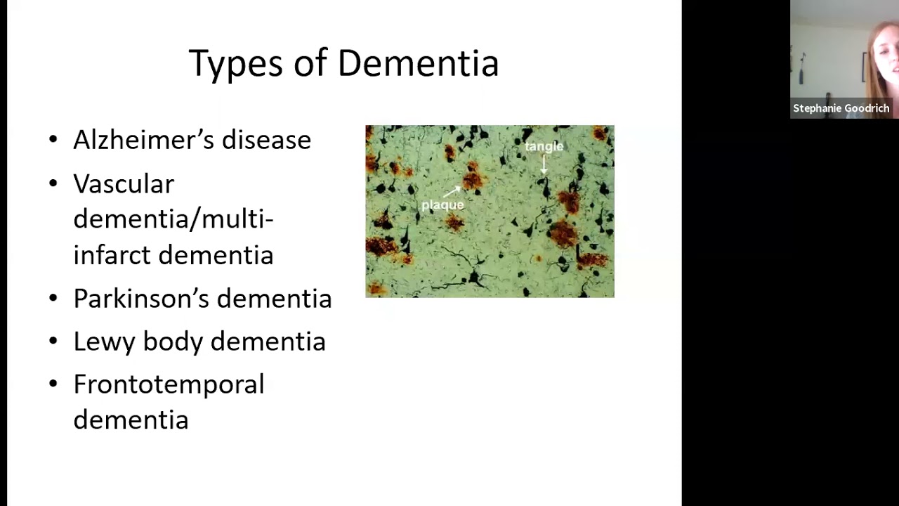 Dementia Webinar by OT ECHO Mentorship