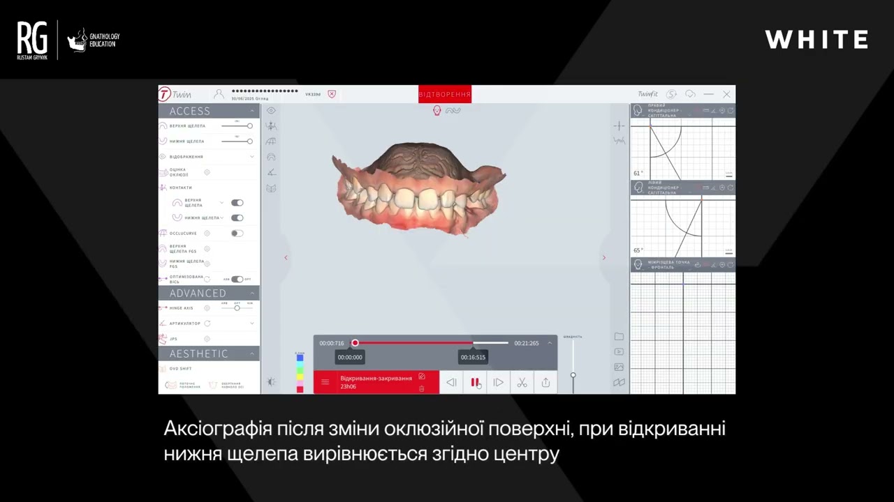 Розбір кейсу: MODJAW | Рустам Гриник