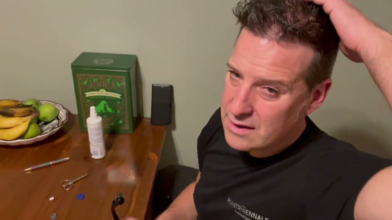 Dr. Balwi Meso Serum Therapy Set Product review Hair Transplant Follow-Up Care