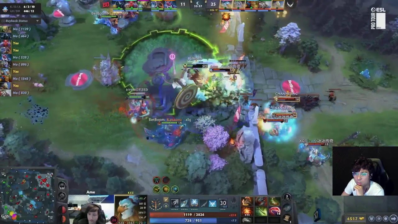 DreamLeague Season28 Group Stage 2 (XG vs BB)