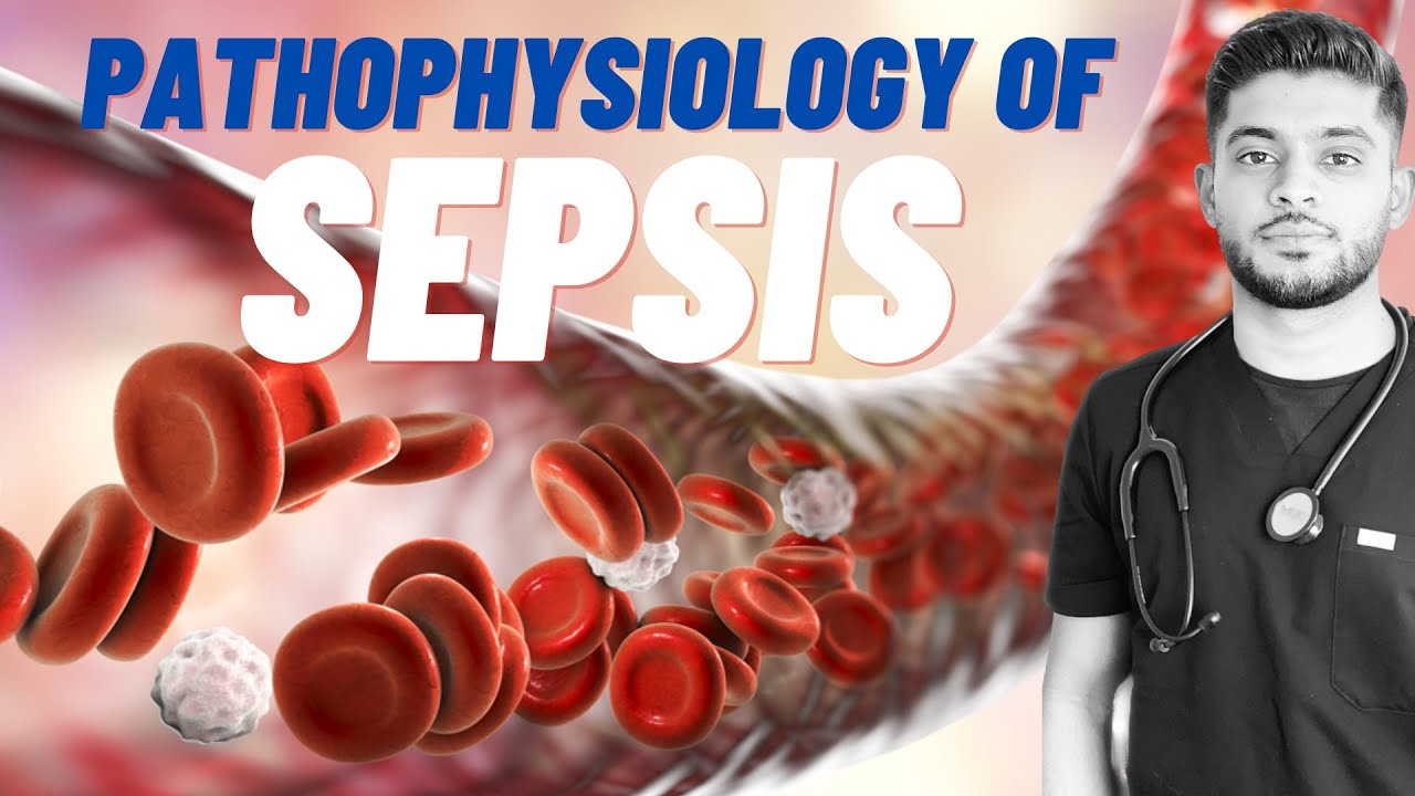 Pathophysiology of Sepsis | MicroPharm