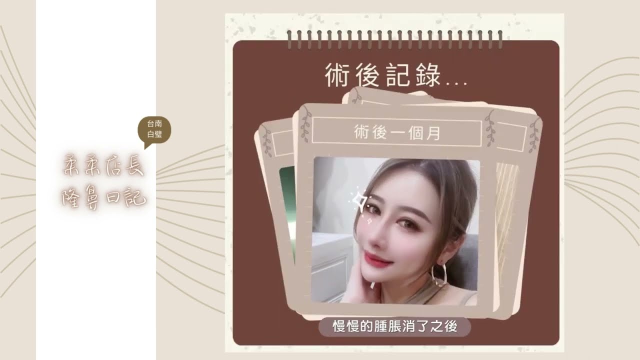 【江奕翰隆鼻】直擊白璧資深店長柔柔美女術後真情告白-台南隆鼻
