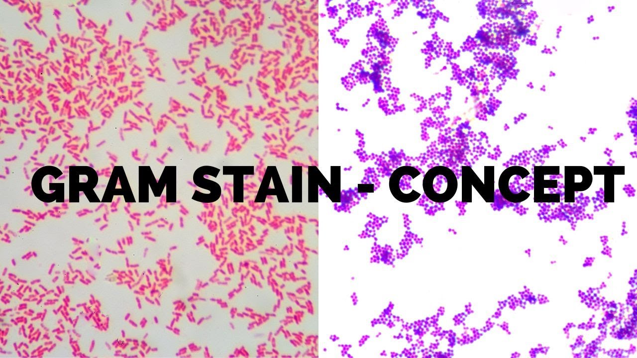 Gram Staining Procedure I differences between Gram positive and Gram negative bacteria.