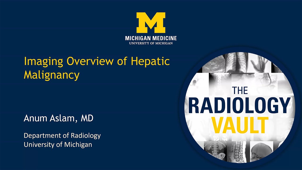 MRI and CT of Primary Liver Cancer