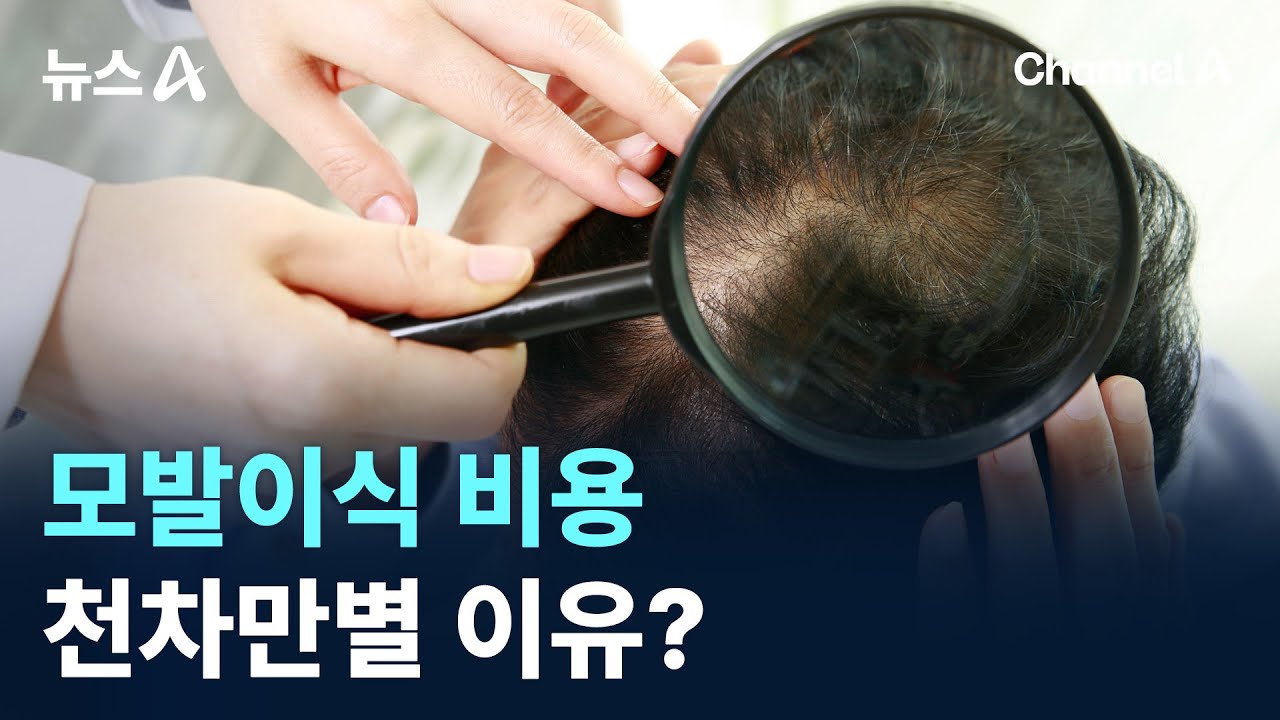 모발이식 비용 200만~600만 원…천차만별 이유? / 채널A / 뉴스A