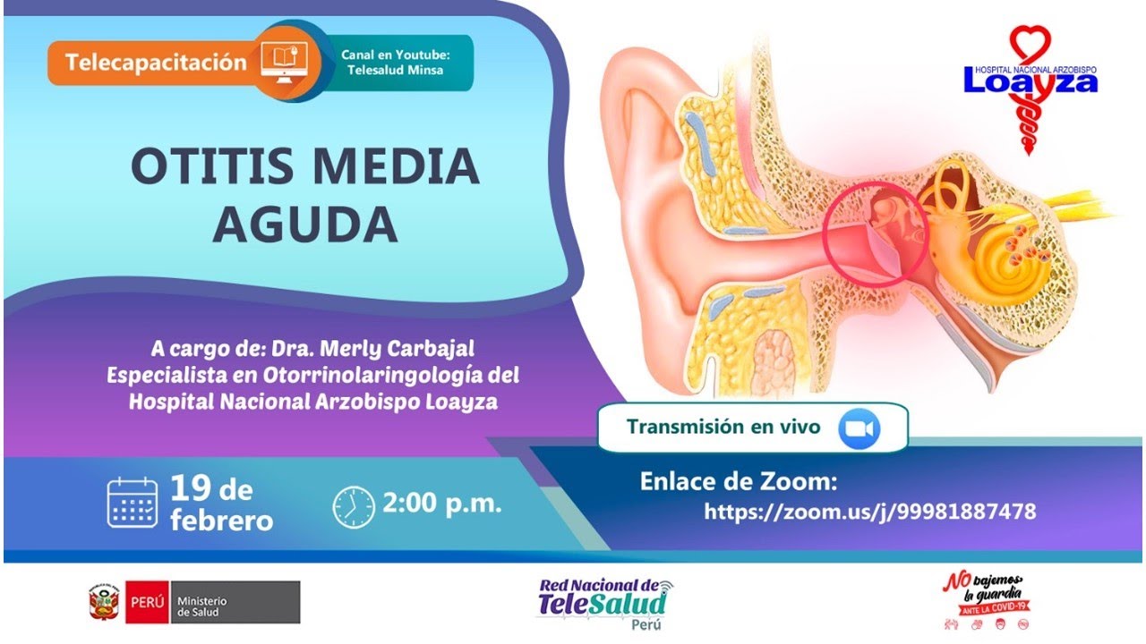 OTITIS MEDIA AGUDA