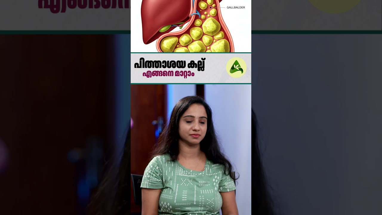 പിത്താശയ കല്ല് എങ്ങനെ മാറ്റാം #Gallstones #GallbladderHealth #healthawareness #ArogyaKaumudy #health