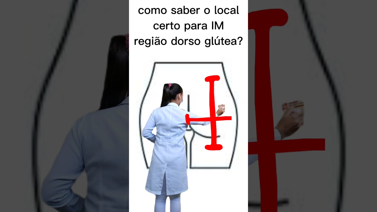 Local certo para IM regi&atilde;o dorso gl&uacute;tea