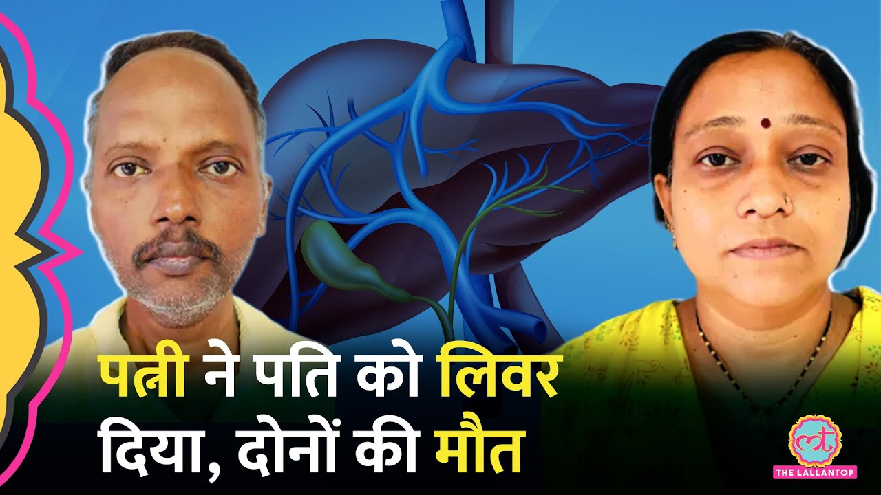 Pune में Liver Transplant के बाद पति-पत्नी की मौत, ऐसी सर्जरी में Donor की जान को कितना रिस्क?
