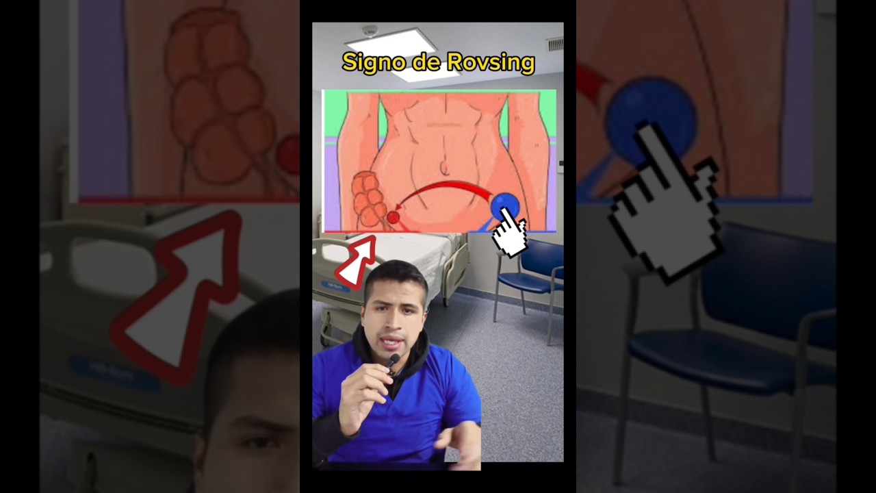 Signo de Rovsing