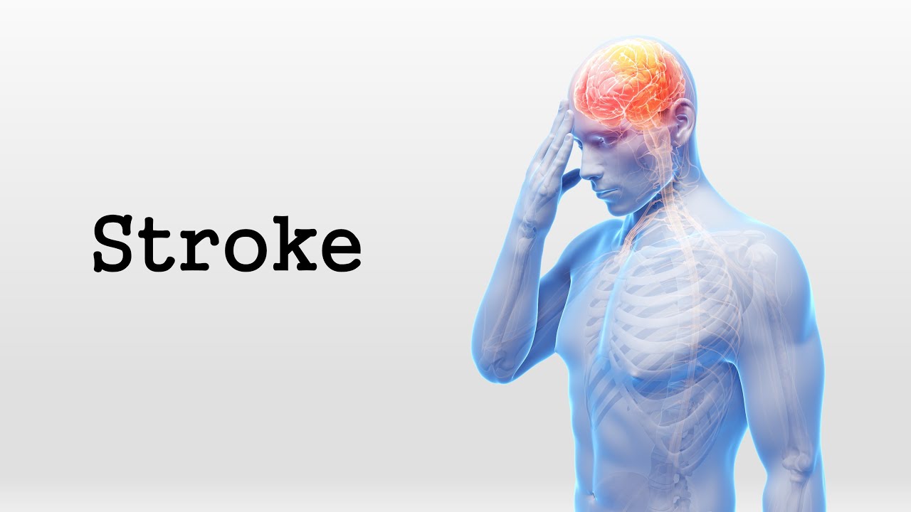 Stroke