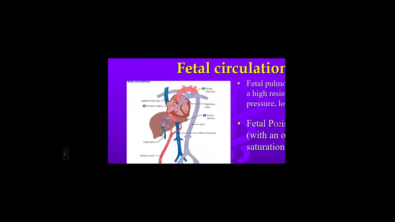 Persistent Pulmonary Hypertension PPHN How To Think WIith? Dr Mohamed Farouk Balegh
