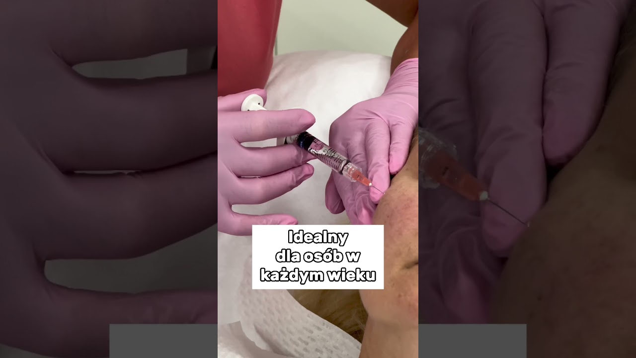 Stymulatory tkankowe co i jak? 💉