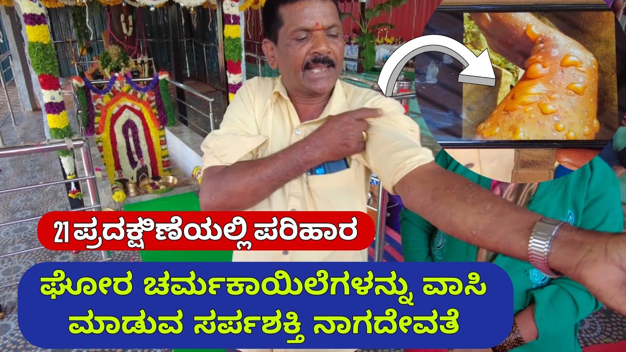ಚರ್ಮರೋಗ ಹಾಗೂ ಕಾಯಿಲೆಗಳನ್ನು ಗುಣಪಡಿಸುವ ನಾಗದೇವತೆ | 21 ಪ್ರದಕ್ಷಿಣೆಯ ಶಕ್ತಿ | ಶ್ರೀ ಸರ್ಪಶಕ್ತಿ ನಾಗದೇವತೆ