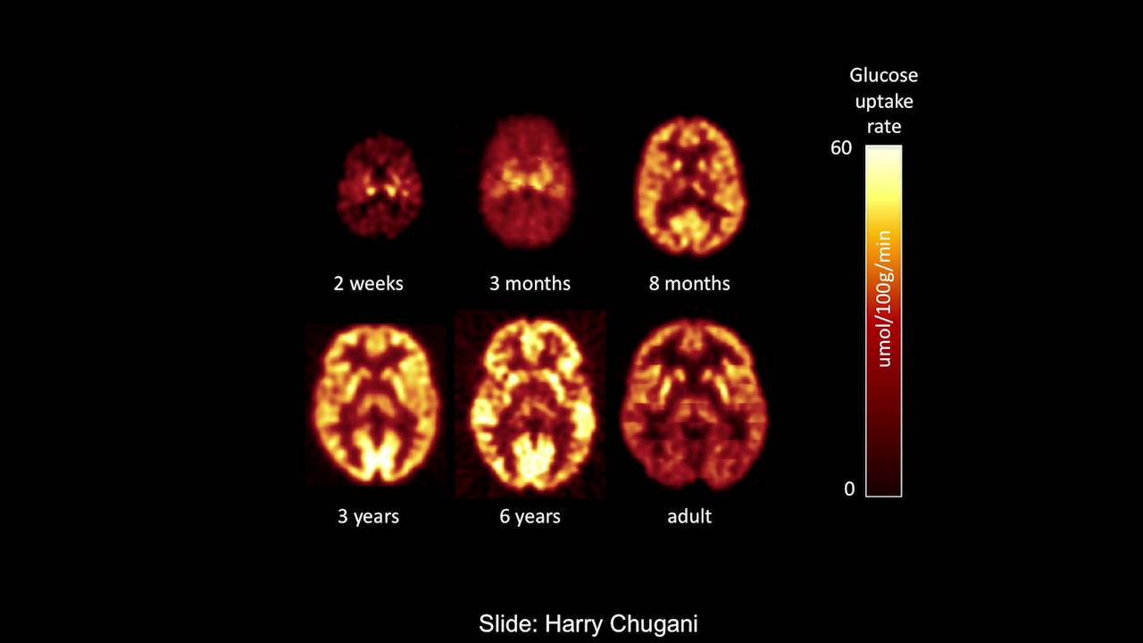Christopher Kuzawa: Brain Energetics and The Evolution of Human Childhood