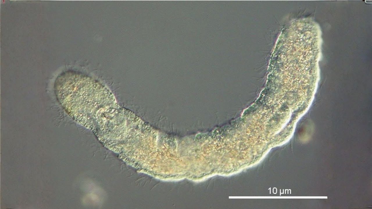 Filo Gnathostomulida: Vermes-de-mandíbula