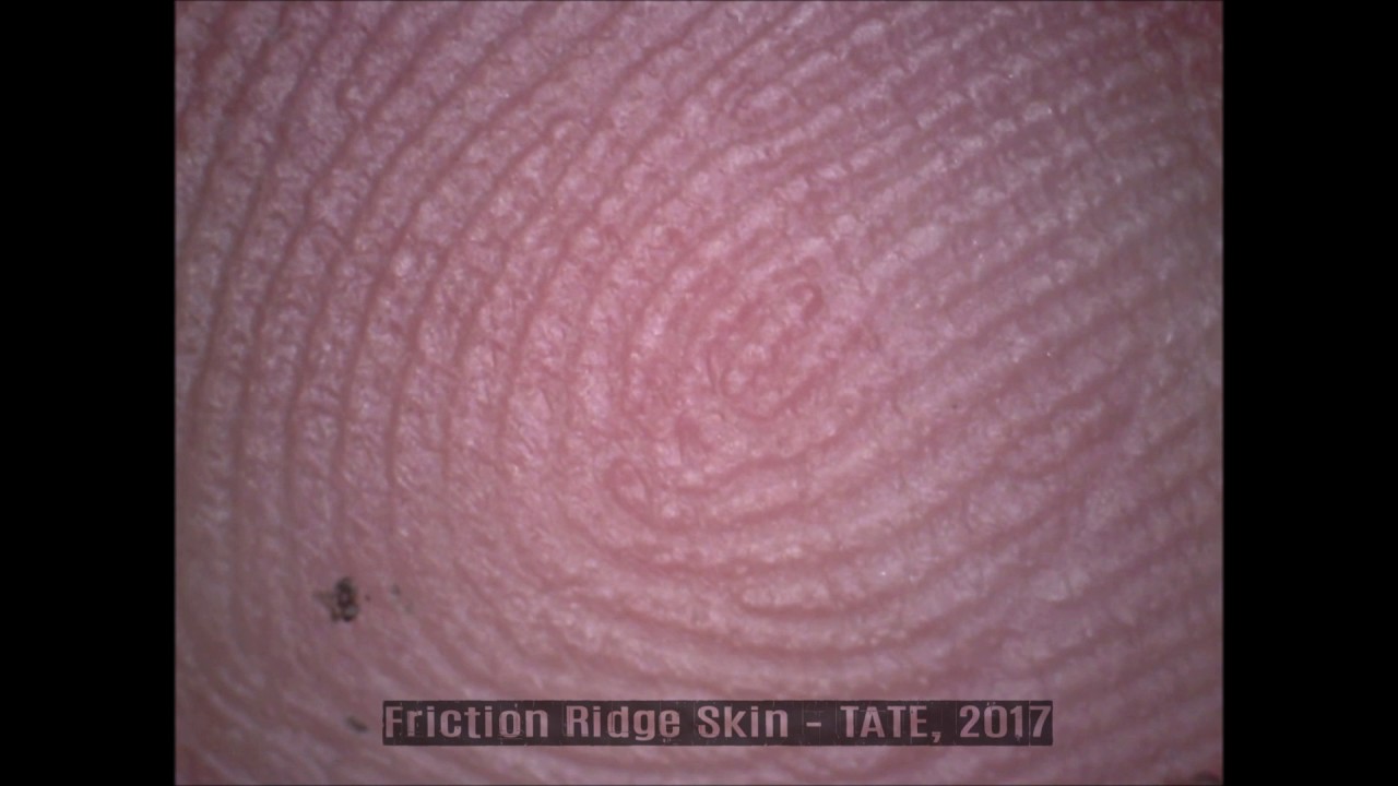 Friction Ridge Skin