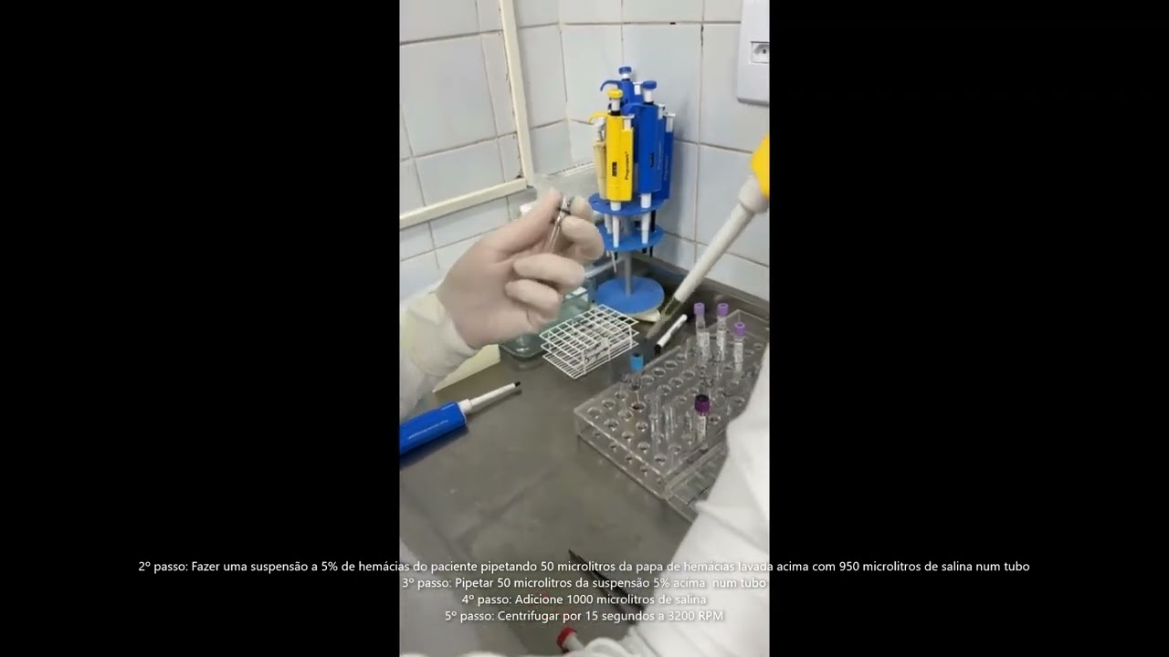 Técnica Coombs Direto   Técnica Tubo