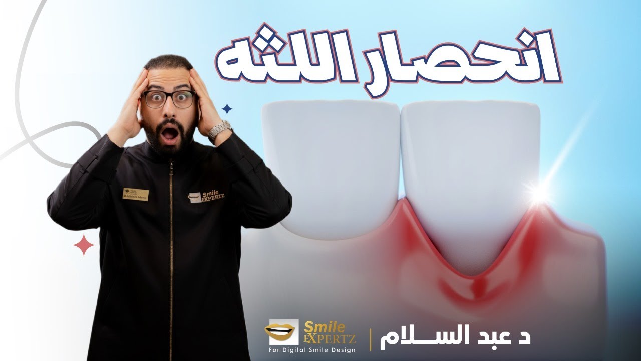 انحصار اللثة خطر صامت! إزاي تمنعه وتعالجه بسهولة ؟
