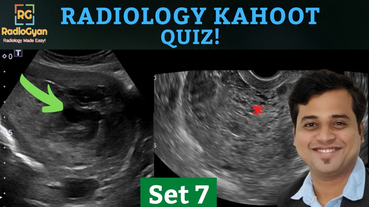 10 High-Yield Radiology Quiz Cases | Kahoot Set 7