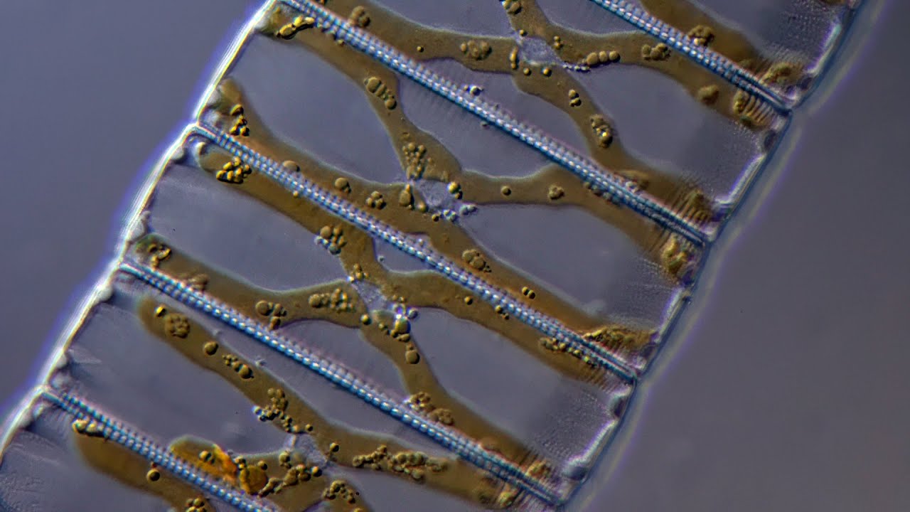 Eunotia pectinalis