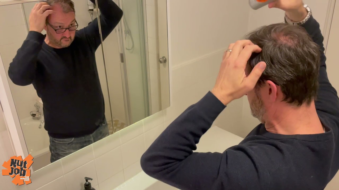 How to Hide Hair Loss on the Crown