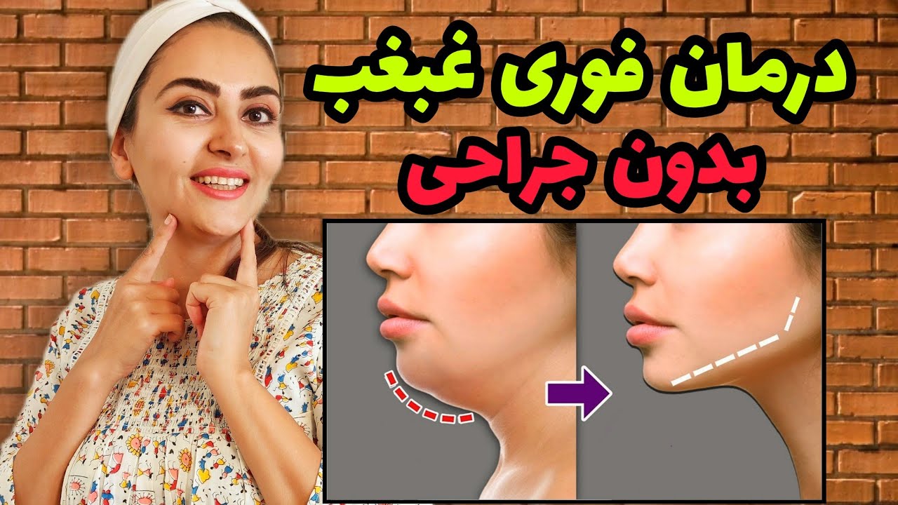 حذف غبغب با لیفت گردن بدون جراحی | غبغب را چگونه از بین ببریم؟