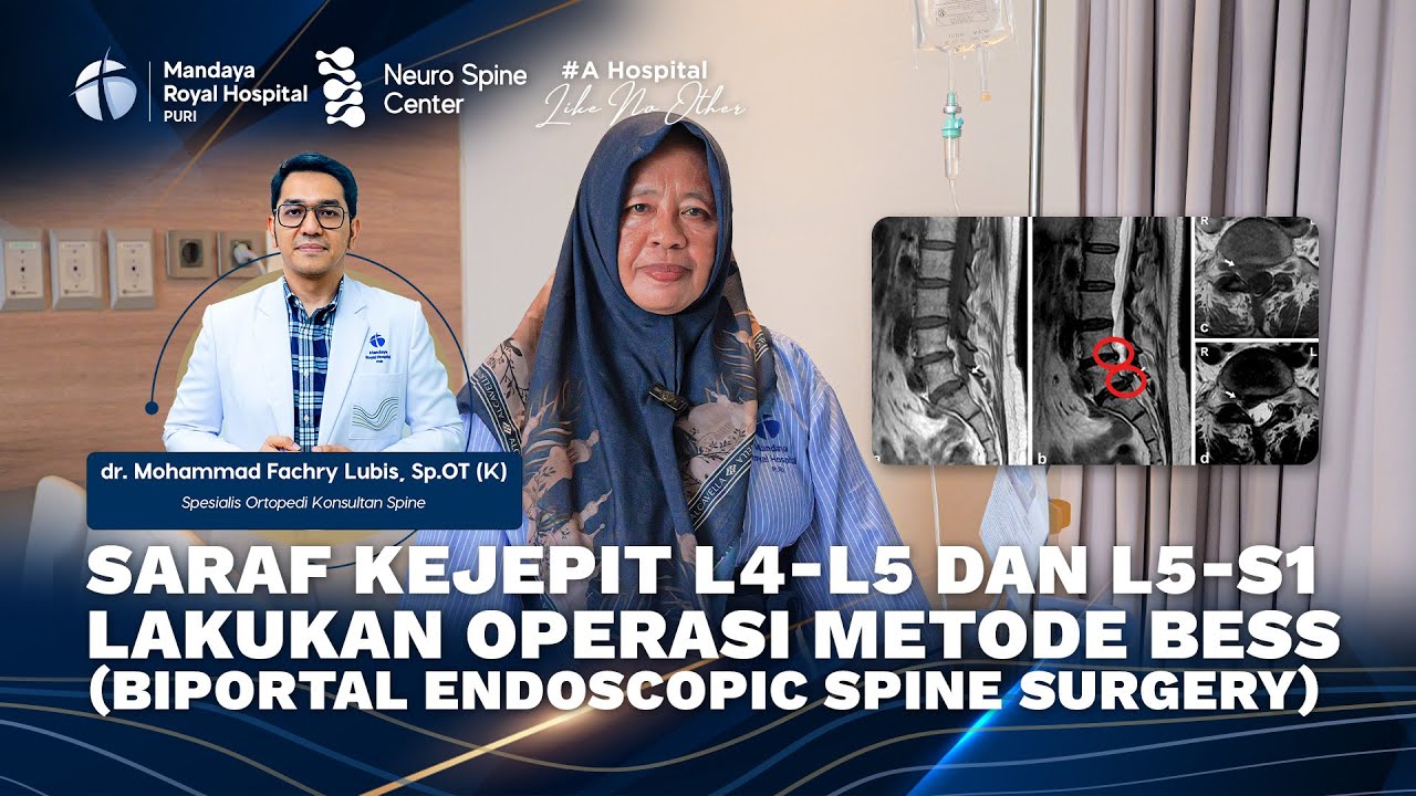 Testimoni Pasien Saraf Kejepit L4-L5 dan L5-S1 Metode BESS | dr. M. Fachry Lubis, Sp.OT (K) Spine