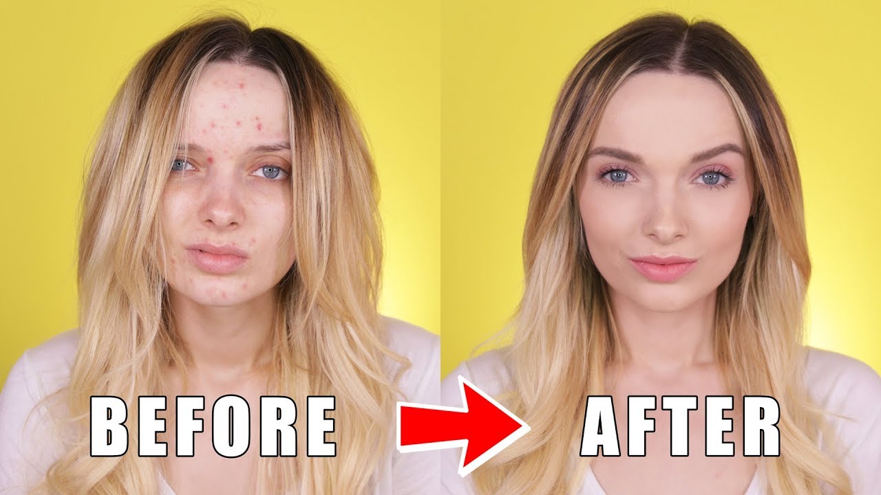 ACNE COVERAGE BACK TO SCHOOL MAKEUP TUTORIAL! // MyPaleSkin