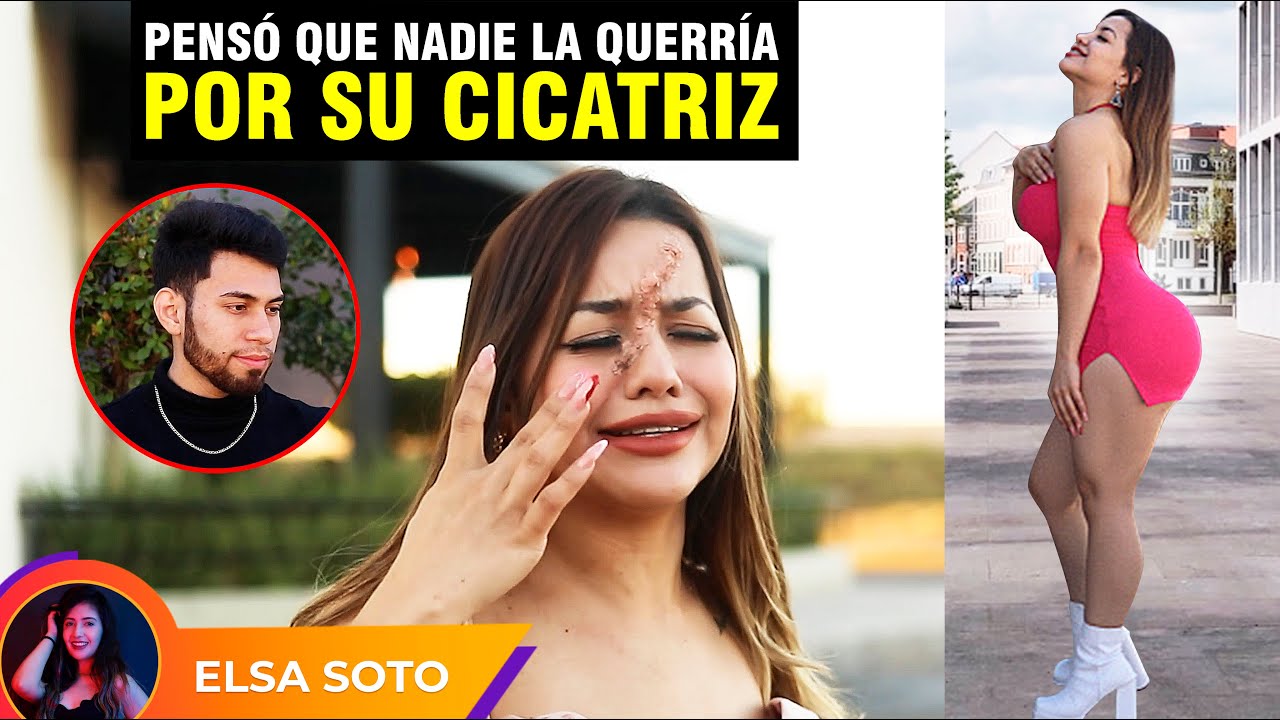 Pensó que nadie la querría por su cicatriz.