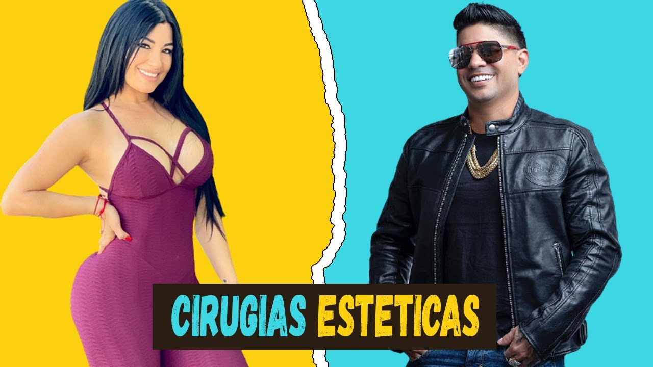 FAMOSOS CUBANOS que admitieron sus CIRUGIAS ESTETICAS. 👀